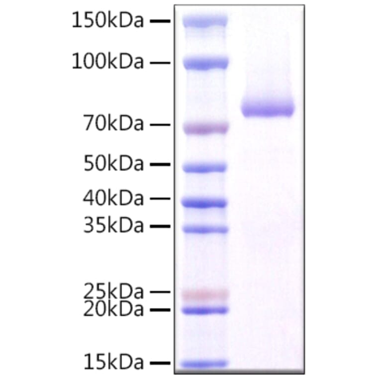 SDS-PAGE - Recombinant Human Dectin-1 Protein (N-terminal Rabbit Fc Tag) (A330527) - Antibodies.com