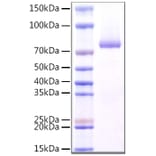 SDS-PAGE - Recombinant Human Dectin-1 Protein (N-terminal Rabbit Fc Tag) (A330527) - Antibodies.com