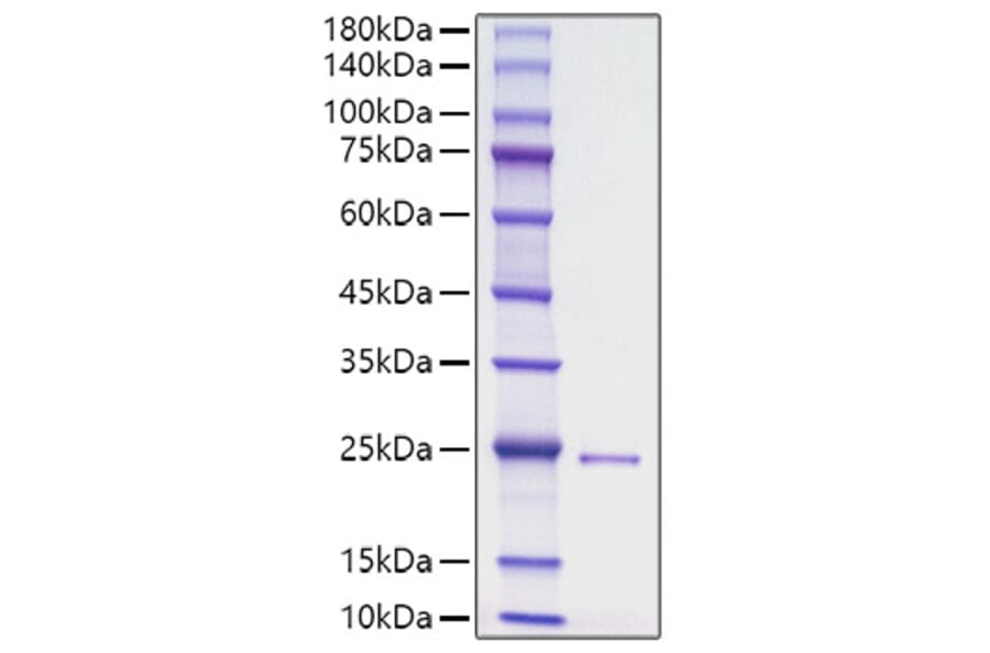 SDS-PAGE - Recombinant Human DHH Protein (N-terminal His Tag) (A330528) - Antibodies.com