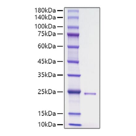 SDS-PAGE - Recombinant Human DHH Protein (N-terminal His Tag) (A330528) - Antibodies.com