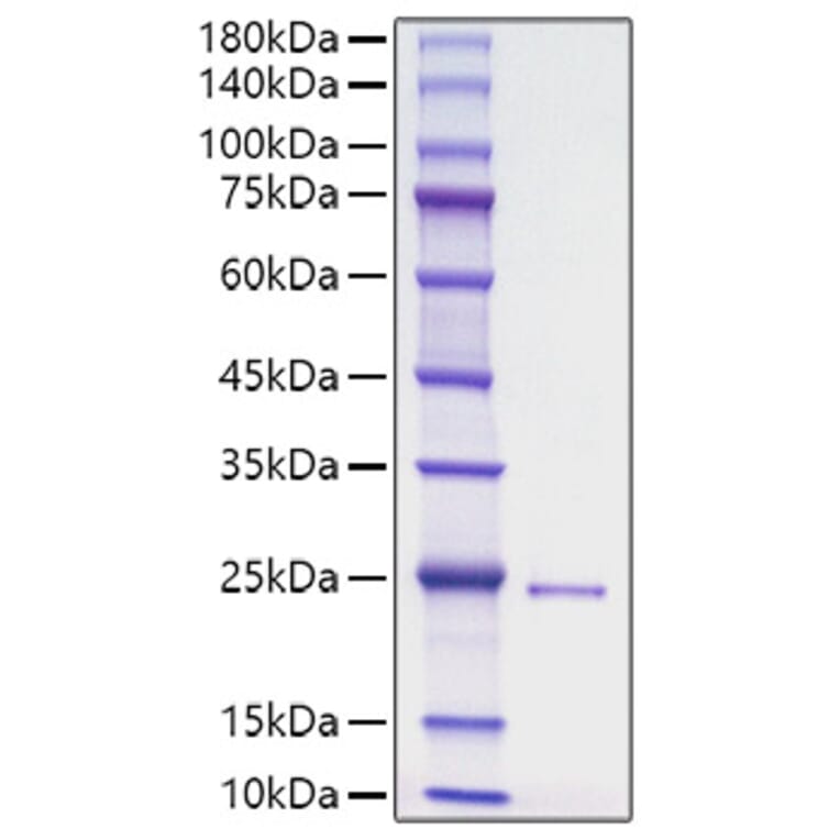 SDS-PAGE - Recombinant Human DHH Protein (N-terminal His Tag) (A330528) - Antibodies.com
