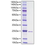 SDS-PAGE - Recombinant Human DHH Protein (N-terminal His Tag) (A330528) - Antibodies.com