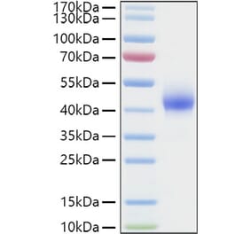 SDS-PAGE - Recombinant Human DKK1 Protein (C-terminal His Tag) (A330529) - Antibodies.com