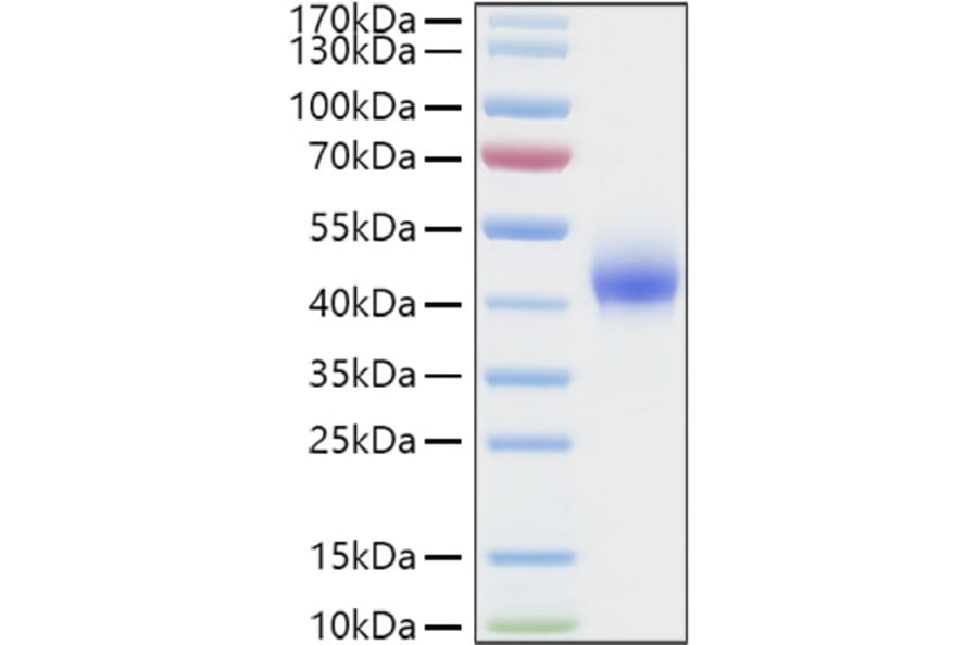 SDS-PAGE - Recombinant Human DKK1 Protein (C-terminal His Tag) (A330529) - Antibodies.com