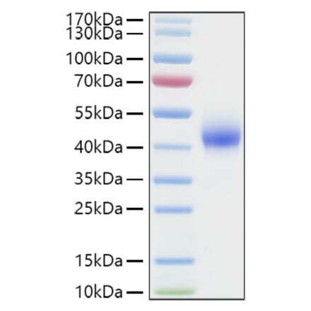 SDS-PAGE - Recombinant Human DKK1 Protein (C-terminal His Tag) (A330529) - Antibodies.com