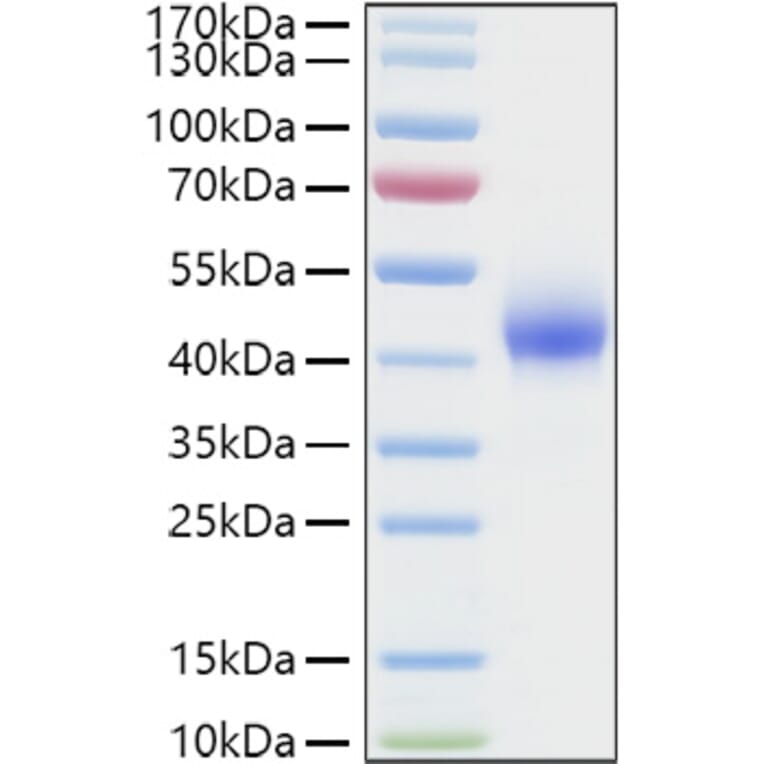 SDS-PAGE - Recombinant Human DKK1 Protein (C-terminal His Tag) (A330529) - Antibodies.com