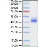 SDS-PAGE - Recombinant Human DKK1 Protein (C-terminal His Tag) (A330529) - Antibodies.com