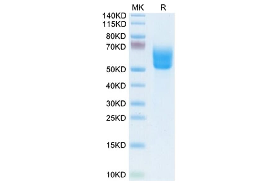 Tris-Bis PAGE - Recombinant Human DKK3 Protein (Biotin) (C-terminal His and Avi Tag) (A330530) - Antibodies.com