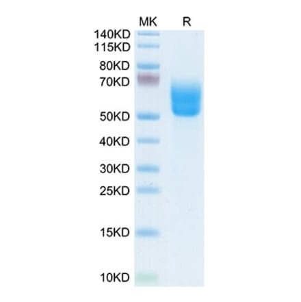 Tris-Bis PAGE - Recombinant Human DKK3 Protein (Biotin) (C-terminal His and Avi Tag) (A330530) - Antibodies.com
