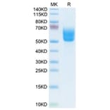 Tris-Bis PAGE - Recombinant Human DKK3 Protein (Biotin) (C-terminal His and Avi Tag) (A330530) - Antibodies.com