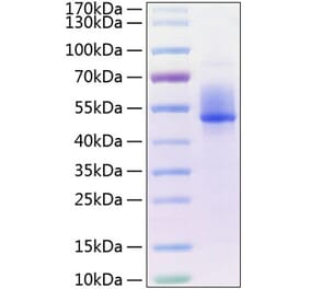 SDS-PAGE - Recombinant Human DKK3 Protein (C-terminal His Tag) (A330531) - Antibodies.com
