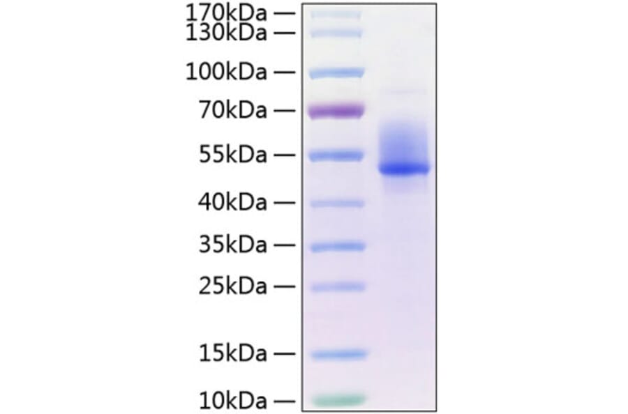 SDS-PAGE - Recombinant Human DKK3 Protein (C-terminal His Tag) (A330531) - Antibodies.com