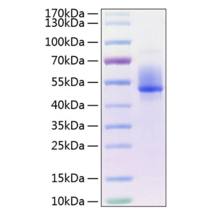 SDS-PAGE - Recombinant Human DKK3 Protein (C-terminal His Tag) (A330531) - Antibodies.com