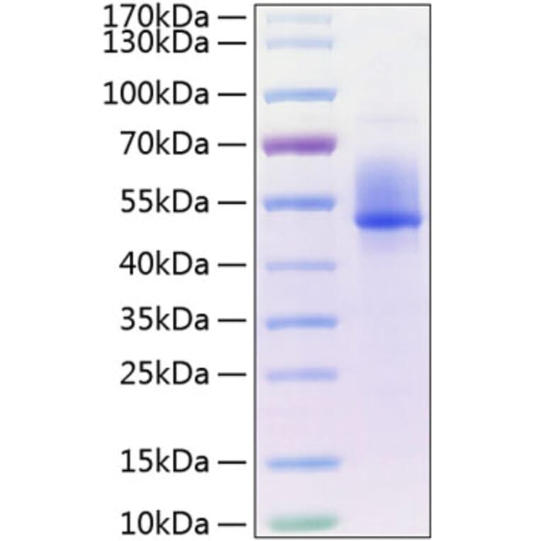SDS-PAGE - Recombinant Human DKK3 Protein (C-terminal His Tag) (A330531) - Antibodies.com