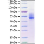 SDS-PAGE - Recombinant Human DKK3 Protein (C-terminal His Tag) (A330531) - Antibodies.com