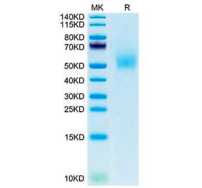 Tris-Bis PAGE - Recombinant Mouse DLK1 Protein (C-terminal His Tag) (A330532) - Antibodies.com