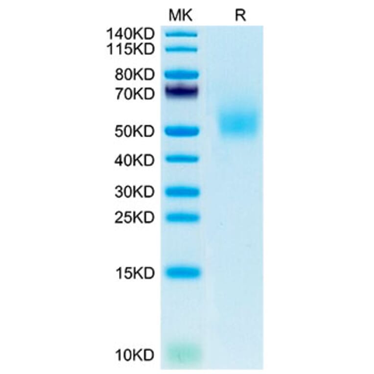 Tris-Bis PAGE - Recombinant Mouse DLK1 Protein (C-terminal His Tag) (A330532) - Antibodies.com