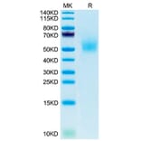 Tris-Bis PAGE - Recombinant Mouse DLK1 Protein (C-terminal His Tag) (A330532) - Antibodies.com