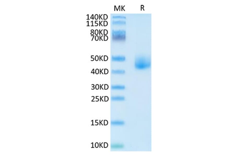 Tris-Bis PAGE - Recombinant Human DLK1 Protein (C-terminal His Tag) (A330533) - Antibodies.com