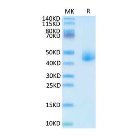 Tris-Bis PAGE - Recombinant Human DLK1 Protein (C-terminal His Tag) (A330533) - Antibodies.com