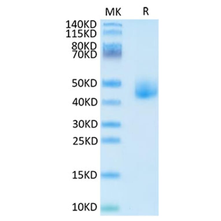 Tris-Bis PAGE - Recombinant Human DLK1 Protein (C-terminal His Tag) (A330533) - Antibodies.com
