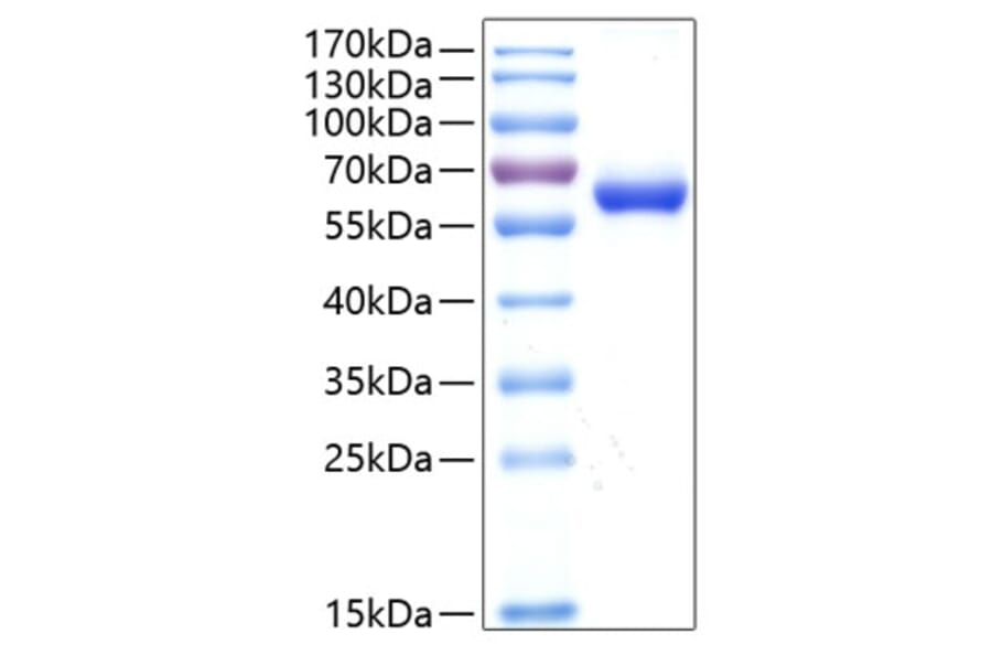 SDS-PAGE - Recombinant Human DLL1 Protein (C-terminal His Tag) (A330534) - Antibodies.com
