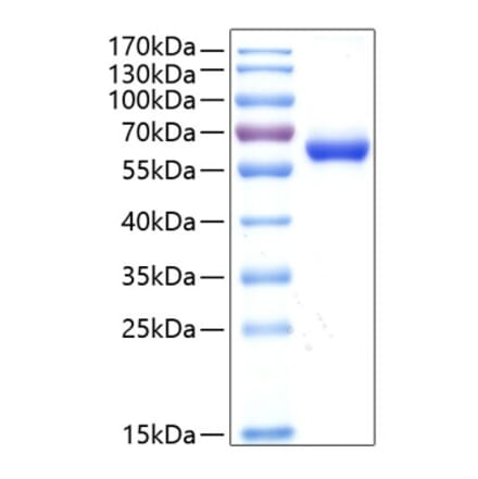 SDS-PAGE - Recombinant Human DLL1 Protein (C-terminal His Tag) (A330534) - Antibodies.com