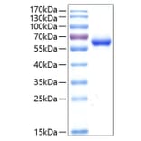 SDS-PAGE - Recombinant Human DLL1 Protein (C-terminal His Tag) (A330534) - Antibodies.com