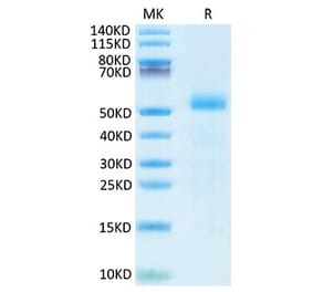 Tris-Bis PAGE - Recombinant Mouse DLL3 Protein (C-terminal His Tag) (A330535) - Antibodies.com