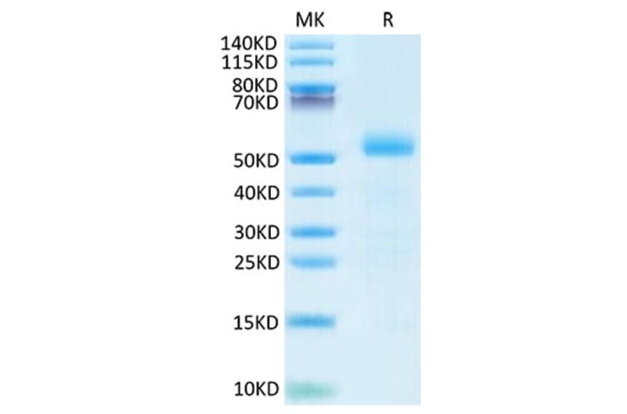 Tris-Bis PAGE - Recombinant Mouse DLL3 Protein (C-terminal His Tag) (A330535) - Antibodies.com