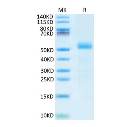 Tris-Bis PAGE - Recombinant Mouse DLL3 Protein (C-terminal His Tag) (A330535) - Antibodies.com