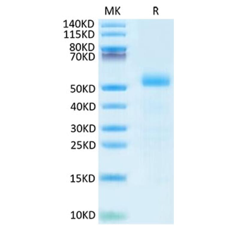 Tris-Bis PAGE - Recombinant Mouse DLL3 Protein (C-terminal His Tag) (A330535) - Antibodies.com
