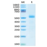 Tris-Bis PAGE - Recombinant Mouse DLL3 Protein (C-terminal His Tag) (A330535) - Antibodies.com