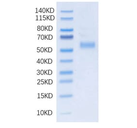 SDS-PAGE - Recombinant Human DLL3 Protein (N-terminal His Tag) (A330536) - Antibodies.com
