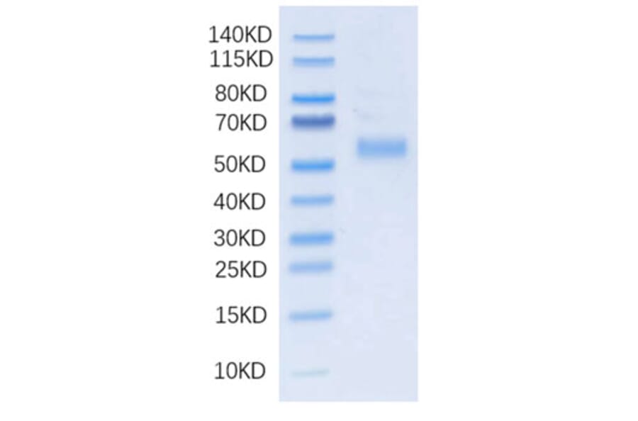 SDS-PAGE - Recombinant Human DLL3 Protein (N-terminal His Tag) (A330536) - Antibodies.com