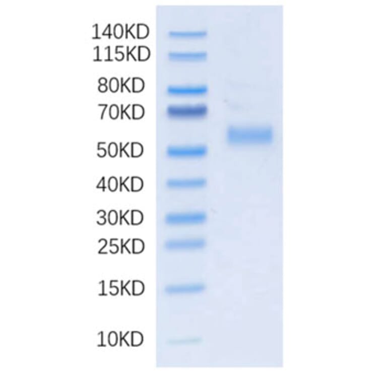 SDS-PAGE - Recombinant Human DLL3 Protein (N-terminal His Tag) (A330536) - Antibodies.com