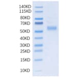 SDS-PAGE - Recombinant Human DLL3 Protein (N-terminal His Tag) (A330536) - Antibodies.com