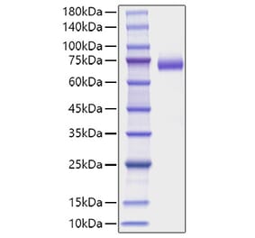 SDS-PAGE - Recombinant Mouse DLL4 Protein (C-terminal His Tag) (A330537) - Antibodies.com