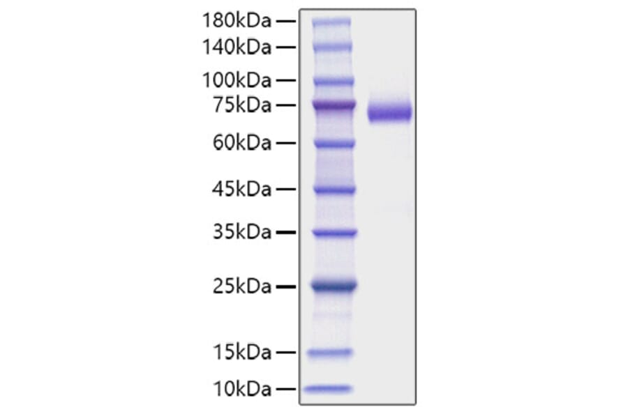 SDS-PAGE - Recombinant Mouse DLL4 Protein (C-terminal His Tag) (A330537) - Antibodies.com