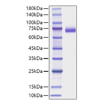 SDS-PAGE - Recombinant Mouse DLL4 Protein (C-terminal His Tag) (A330537) - Antibodies.com