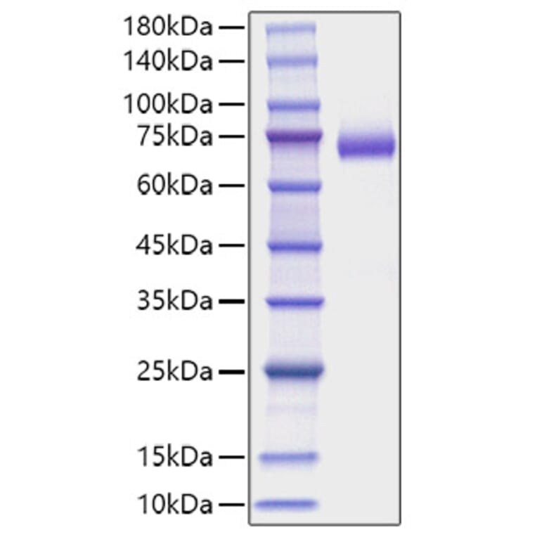 SDS-PAGE - Recombinant Mouse DLL4 Protein (C-terminal His Tag) (A330537) - Antibodies.com