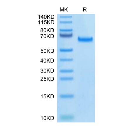 Tris-Bis PAGE - Recombinant Human DLL4 Protein (Biotin) (C-terminal His and Avi Tag) (A330538) - Antibodies.com