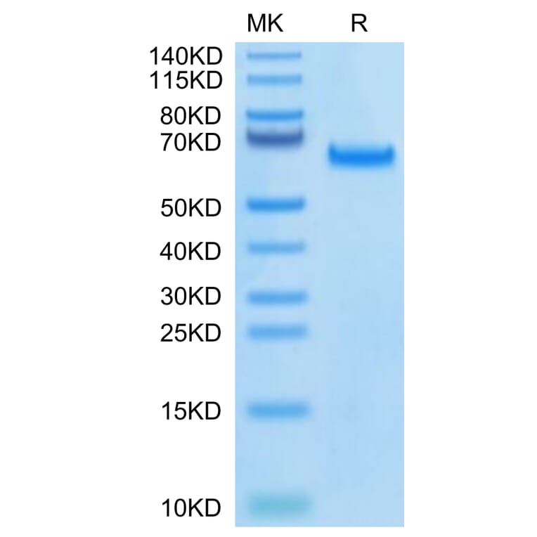 Tris-Bis PAGE - Recombinant Human DLL4 Protein (Biotin) (C-terminal His and Avi Tag) (A330538) - Antibodies.com