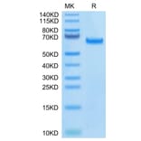 Tris-Bis PAGE - Recombinant Human DLL4 Protein (Biotin) (C-terminal His and Avi Tag) (A330538) - Antibodies.com