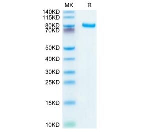 Tris-Bis PAGE - Recombinant Human DLL4 Protein (C-terminal Human Fc Tag) (A330539) - Antibodies.com