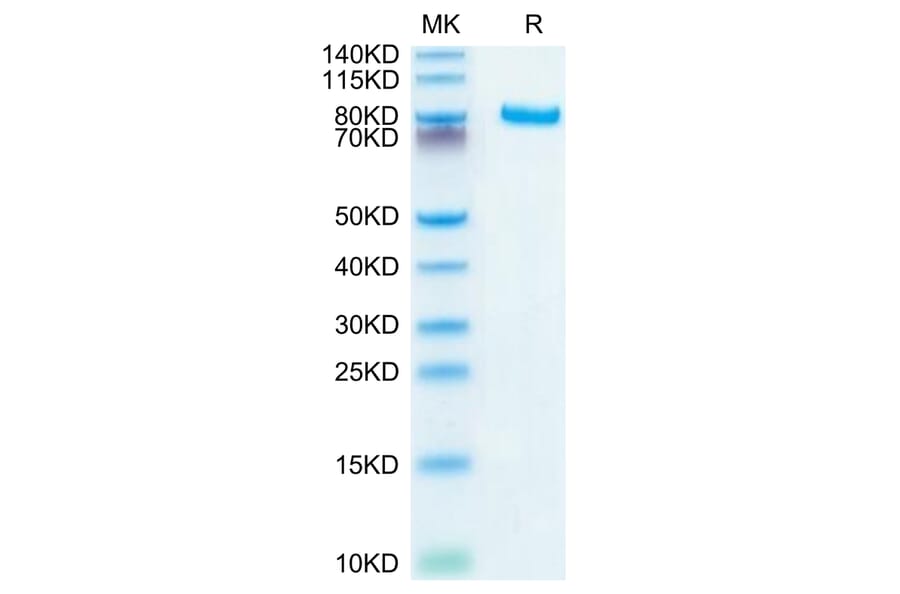 Tris-Bis PAGE - Recombinant Human DLL4 Protein (C-terminal Human Fc Tag) (A330539) - Antibodies.com