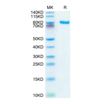 Tris-Bis PAGE - Recombinant Human DLL4 Protein (C-terminal Human Fc Tag) (A330539) - Antibodies.com