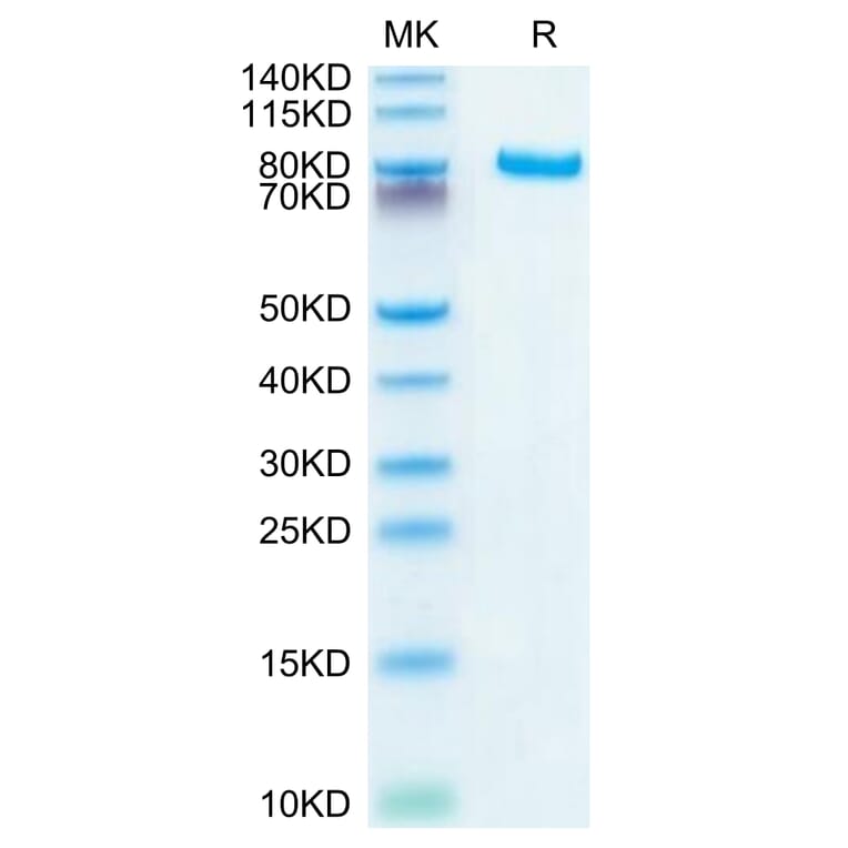 Tris-Bis PAGE - Recombinant Human DLL4 Protein (C-terminal Human Fc Tag) (A330539) - Antibodies.com