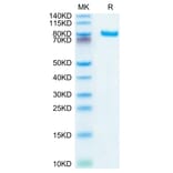 Tris-Bis PAGE - Recombinant Human DLL4 Protein (C-terminal Human Fc Tag) (A330539) - Antibodies.com
