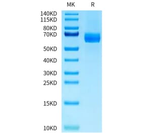 Tris-Bis PAGE - Recombinant Human DLL4 Protein (C-terminal His Tag) (A330540) - Antibodies.com